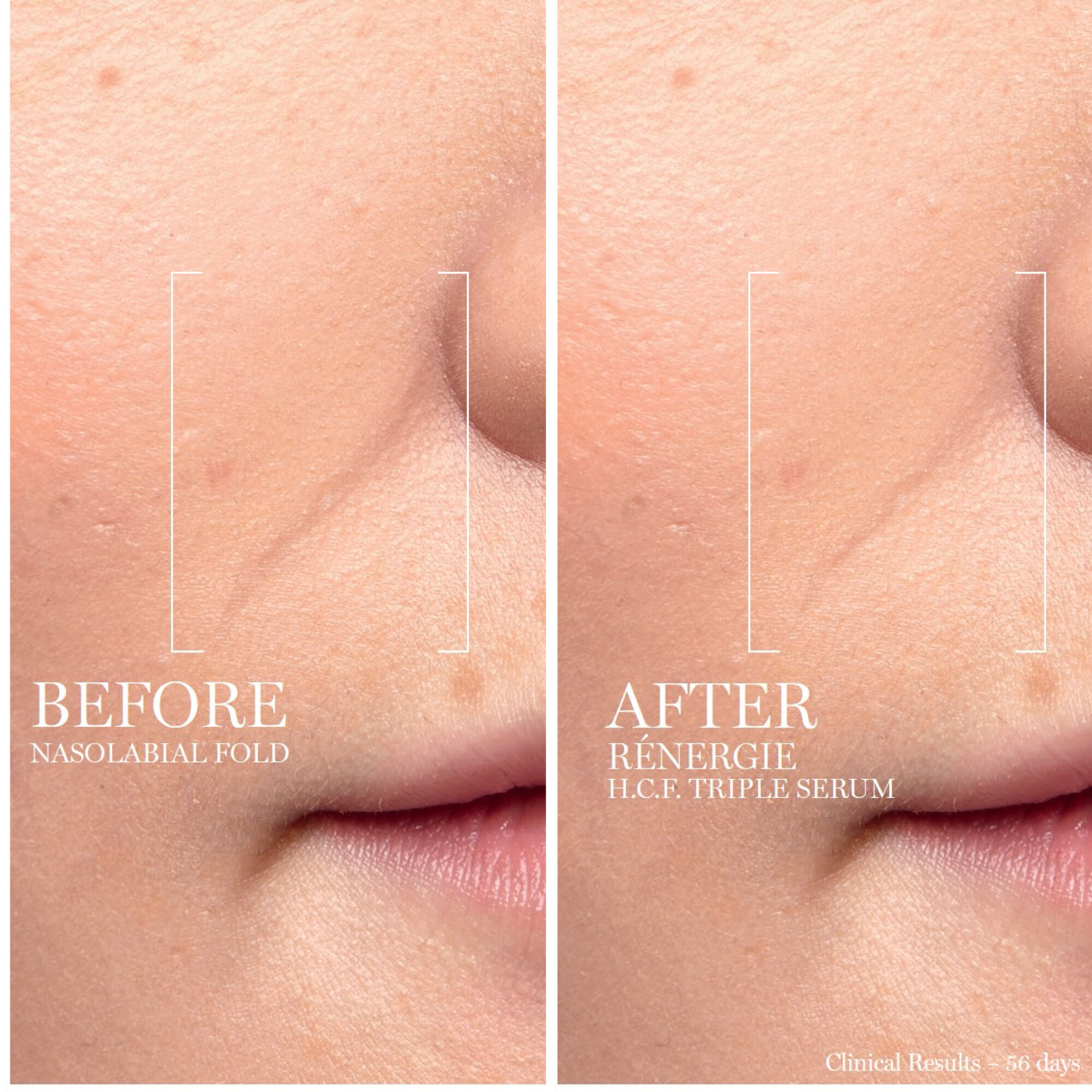 SERUM TƯƠI 3 LOI RENERGIE H.C.F TRIPLE