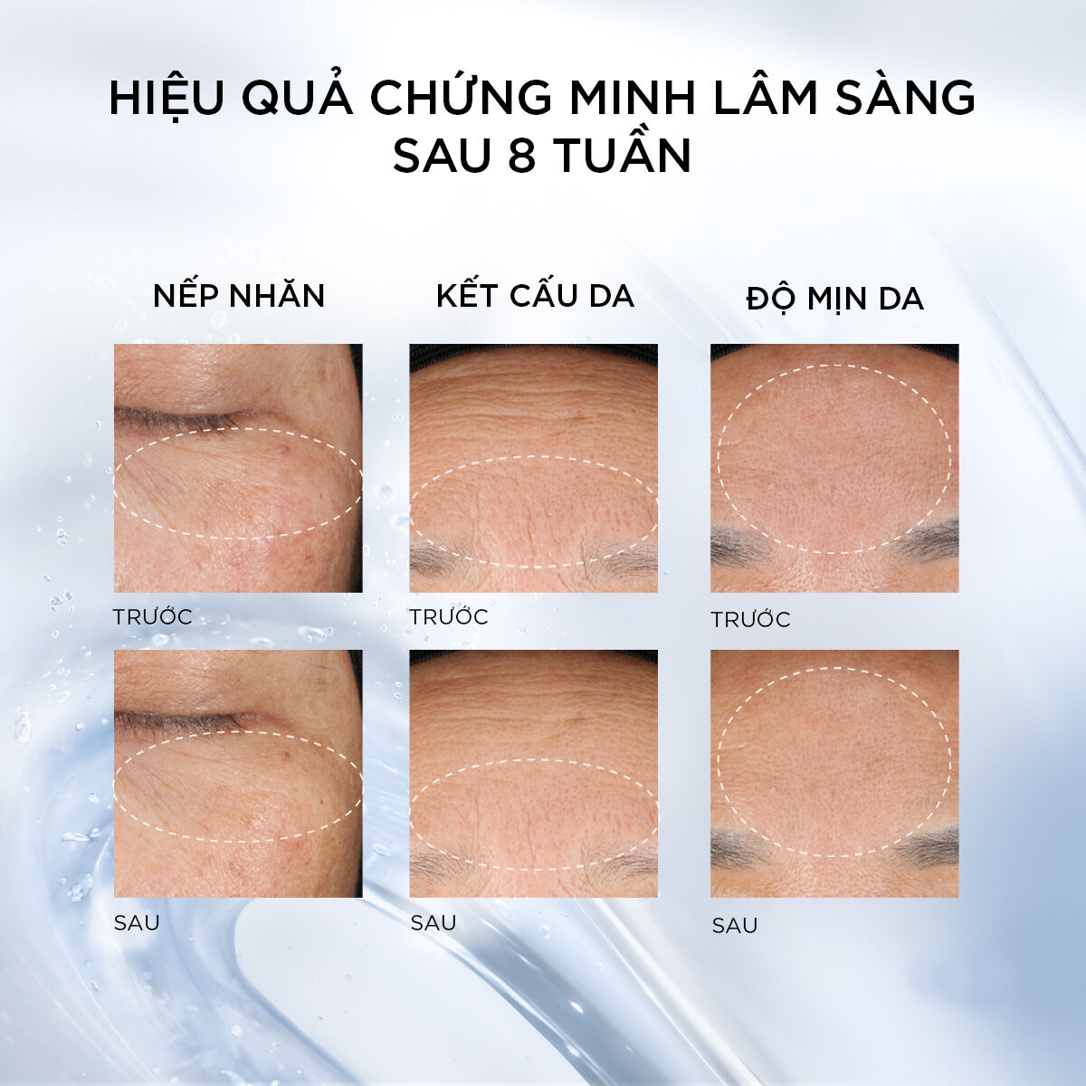 Genifique Ultimate Serum