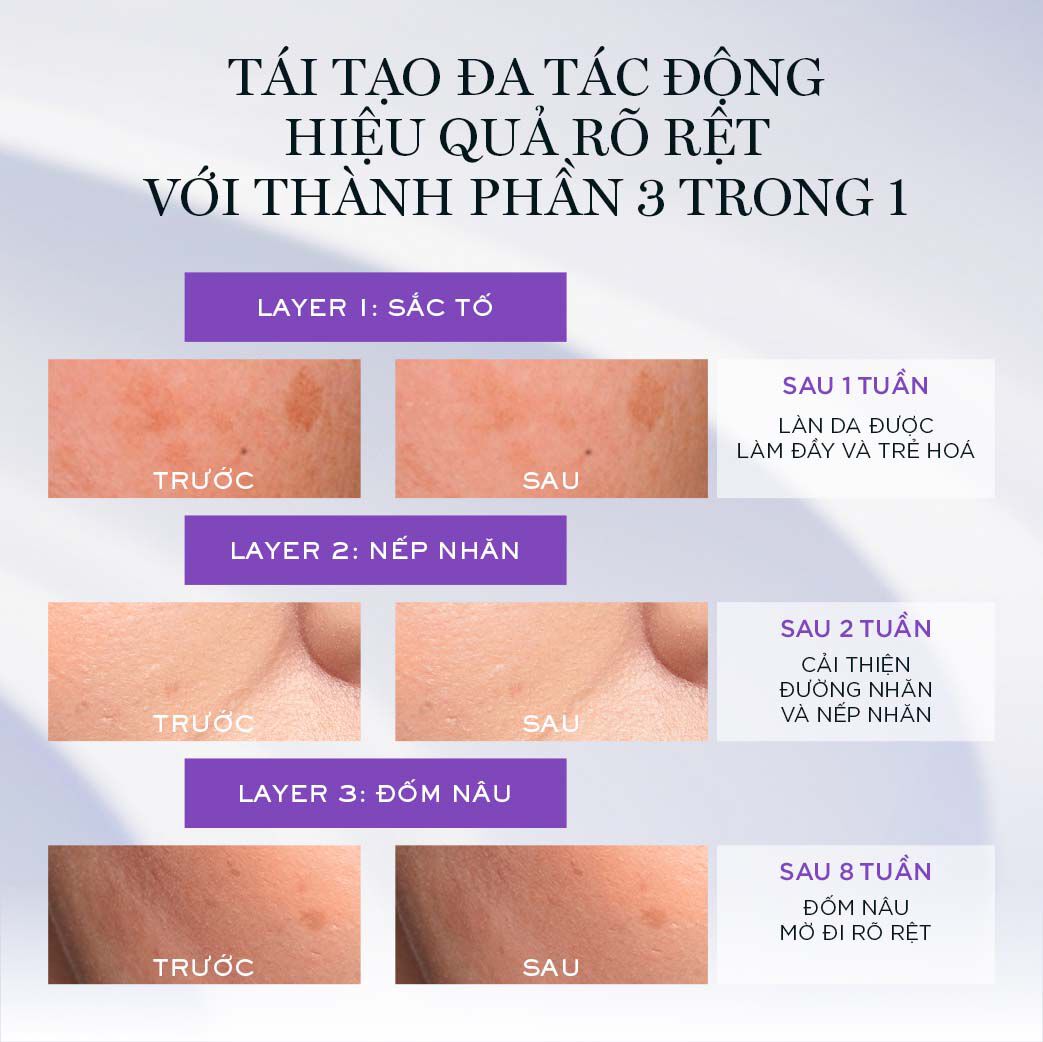 SERUM TƯƠI 3 LOI RENERGIE H.C.F TRIPLE