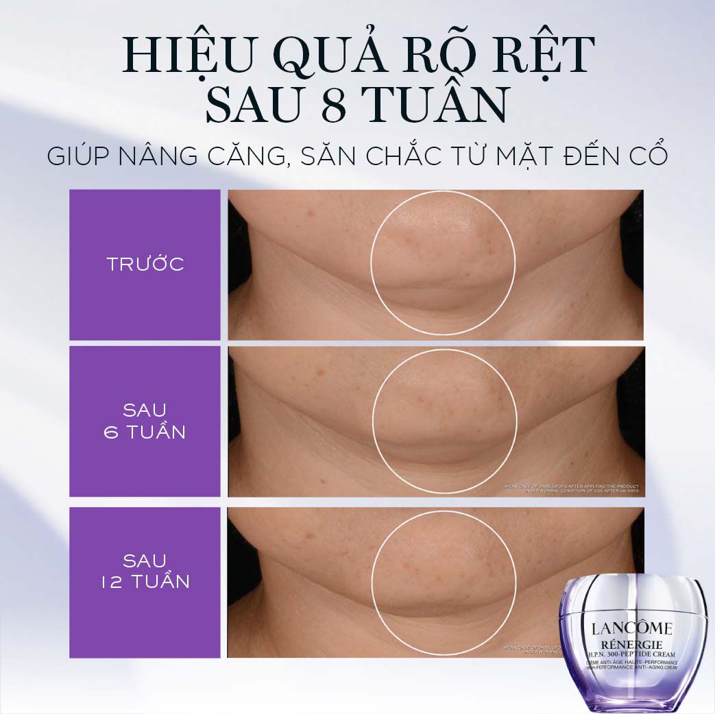 KEM DƯỠNG RENERGIE 300-PEPTIDE