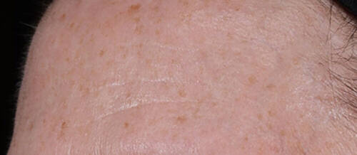 Serum Génifique Ultimate Serum 115ml 10 fine lines and wrinkles after